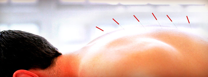 Китайская медицина Китайская медицина