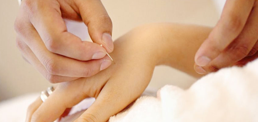 Китайская рефлексотерапия дает потрясающий результат Игла в руке