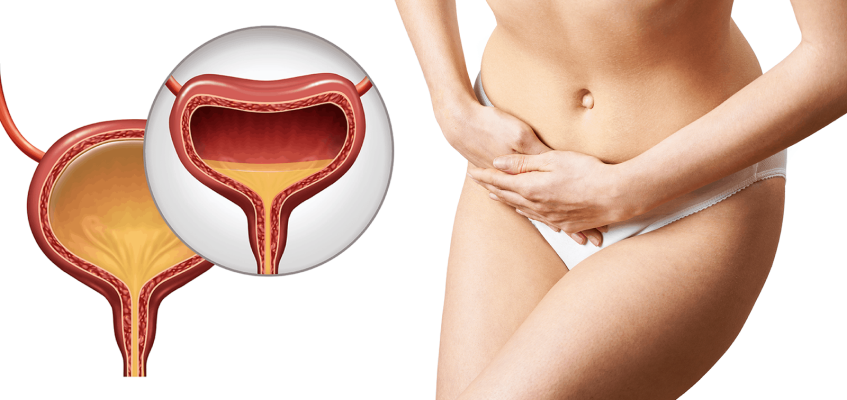 цистит симптомы